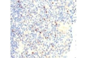 IHC analysis of FOXP3 antibody and human tonsil tissue. (FOXP3 anticorps  (N-Term))