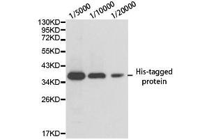 Western blot analysis of over-expressed His-tagged protein in 293T cell using His-tag antibody. (His Tag anticorps)