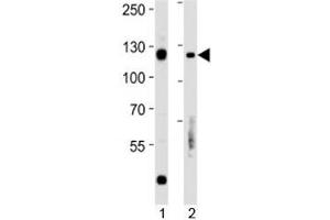 Rb antibody western blot analysis in 1) Daudi and 2) Raji lysate. (Retinoblastoma Protein (Rb) anticorps  (AA 586-615))