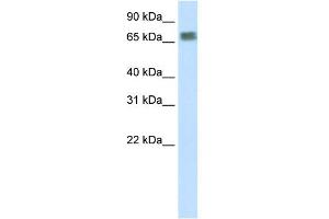 WB Suggested Anti-ZFP64 Antibody Titration:  2. (ZFP64 anticorps  (N-Term))