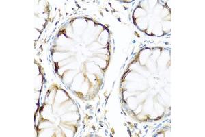 Immunohistochemistry of paraffin-embedded human colon using APCS antibody (ABIN5971040) at dilution of 1/100 (40x lens). (APCS anticorps)