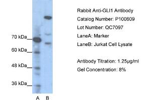WB Suggested Anti-GLI1  Antibody Titration: 1. (GLI1 anticorps  (N-Term))