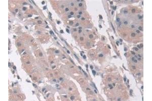 Detection of AASS in Human Stomach Tissue using Polyclonal Antibody to Aminoadipate Semialdehyde Synthase (AASS)