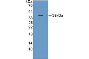 Detection of Recombinant ITIH1, Human using Polyclonal Antibody to Inter Alpha-Globulin Inhibitor H1 (ITIH1) (ITIH1 anticorps  (AA 507-819))