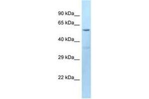 Image no. 1 for anti-Dopachrome Tautomerase (DCT) (AA 41-90) antibody (ABIN6747923) (DCT anticorps  (AA 41-90))