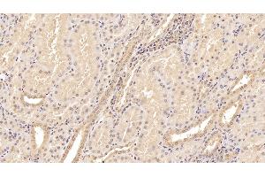 Detection of TNC in Human Kidney Tissue using Monoclonal Antibody to Tenascin C (TNC) (TNC anticorps  (AA 49-181))