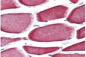Anti-GPR43 antibody  ABIN1048823 IHC staining of human skeletal muscle. (FFAR2 anticorps  (Internal Region))