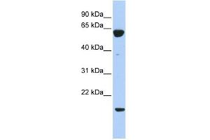 PTP4A3 antibody used at 1 ug/ml to detect target protein. (PTP4A3 anticorps  (Middle Region))