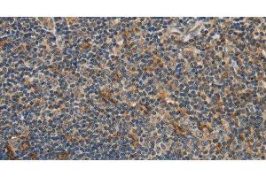 Immunohistochemistry of paraffin-embedded Human tonsil using GGT1 Polyclonal Antibody at dilution of 1:40