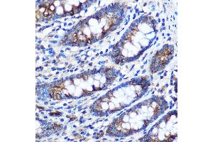 Immunohistochemistry of paraffin-embedded Human colon using ST Rabbit pAb (ABIN1682908, ABIN1682909, ABIN5664112 and ABIN6219730) at dilution of 1:100 (40x lens).