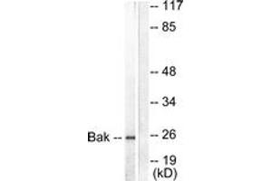 Western blot analysis of extracts from 293 cells, using Bak Antibody. (BAK1 anticorps  (AA 1-50))