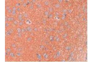 IHC-P analysis of Rat Brain Tissue, with DAB staining. (SPTAN1 anticorps  (AA 2071-2269))