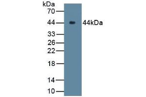 Western blot analysis of recombinant Rabbit C9. (C9 anticorps  (AA 139-519))