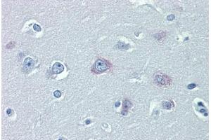 Brain, cortex, Human: Formalin-Fixed, Paraffin-Embedded (FFPE)