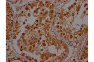 IHC image of ABIN7150422 diluted at 1:400 and staining in paraffin-embedded human testis tissue performed on a Leica BondTM system.