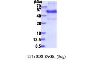 SDS-PAGE (SDS) image for Kruppel-Like Factor 12 (KLF12) (AA 1-402) protein (His tag) (ABIN5853895)