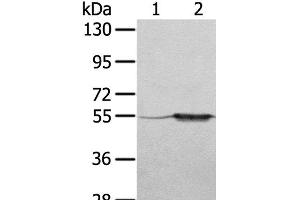 Western Blot analysis of A375 cell and Human fetal muscle tissue using TRIM35 Polyclonal Antibody at dilution of 1:550 (TRIM35 anticorps)