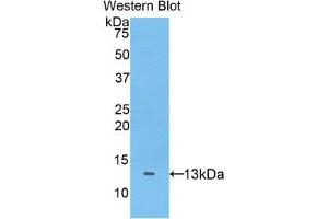 Western Blotting (WB) image for anti-ADAM Metallopeptidase with Thrombospondin Type 1 Motif, 7 (ADAMTS7) (AA 1589-1686) antibody (ABIN3205721) (ADAMTS7 anticorps  (AA 1589-1686))