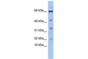 Image no. 1 for anti-LIM Domain Only 2 (Rhombotin-Like 1) (LMO2) (AA 35-84) antibody (ABIN6744411)