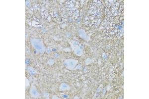 Immunohistochemistry of paraffin-embedded mouse spinal cord using B2 antibody (ABIN7265773) at dilution of 1:100 (40x lens).