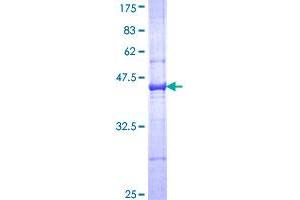 Image no. 1 for Complement Component 3 (C3) (AA 1534-1644) protein (GST tag) (ABIN1347501)