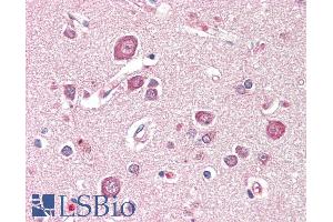 ABIN1019666 (5µg/ml) staining of paraffin embedded Human Cortex. (SDCCAG8 anticorps  (Internal Region))
