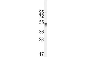 TNFR1 antibody western blot analysis in A549 lysate