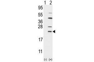 Western blot analysis of UBE2C (arrow) using rabbit polyclonal UBE2C Antibody (UBE2C anticorps  (N-Term))