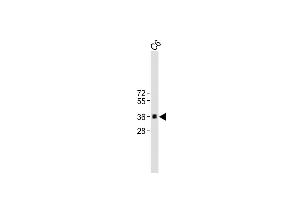All lanes : Anti-CCND1 at 1:2000 dilution Lane 1: C6 whole cell lysate Lysates/proteins at 20 μg per lane. (Cyclin D1 anticorps)