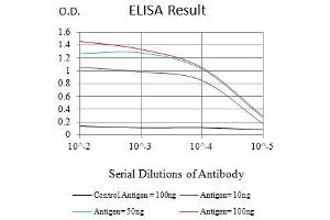 Black line: Control Antigen (100 ng),Purple line: Antigen (10 ng), Blue line: Antigen (50 ng), Red line:Antigen (100 ng)