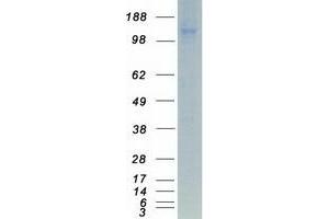 Validation with Western Blot