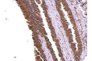 IHC-P Image alpha Adducin antibody detects alpha Adducin protein at membrane and cytosol on mouse esophagus by immunohistochemical analysis. (alpha Adducin anticorps)