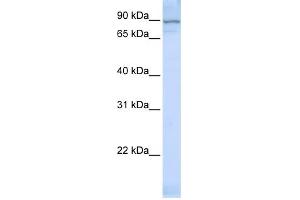 WB Suggested Anti-ZNF598 Antibody Titration:  0. (ZNF598 anticorps  (Middle Region))