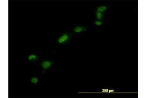 Immunofluorescence of monoclonal antibody to HMGB1 on HeLa cell. (HMGB1 anticorps  (AA 1-215))