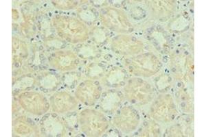 Immunohistochemistry of paraffin-embedded human kidney tissue using ABIN7145332 at dilution of 1:100 (BNIP3L/NIX anticorps  (AA 1-187))
