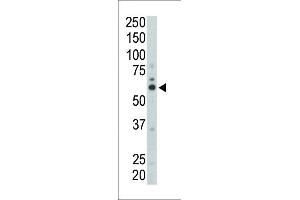 Western blot analysis of anti-FYN (N-term) Pab (ABIN392098 and ABIN2841850) in mouse liver tissue lysate.