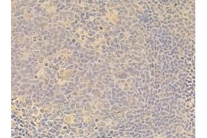SGK1 Antibody at 1/100 staining human normal tonsil tissue by IHC-P. (SGK1 anticorps)