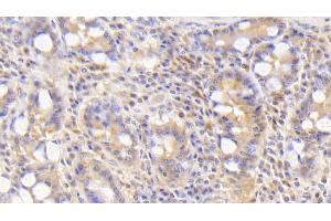 Detection of BMP2 in Human Small intestine Tissue using Polyclonal Antibody to Bone Morphogenetic Protein 2 (BMP2)