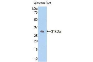 Western Blotting (WB) image for anti-C-Reactive Protein (CRP) (AA 20-225) antibody (ABIN1077877) (CRP anticorps  (AA 20-225))