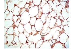 Rat visceral white fat tissue was stained by Rabbit Anti-Vaspin (386-414) (Human) Serum