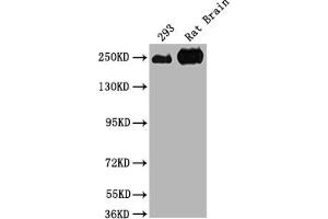 Western Blot Positive WB detected in: 293 whole cell lysate, Rat Brain tissue All lanes: MYH10 antibody at 1:2000 Secondary Goat polyclonal to rabbit IgG at 1/50000 dilution Predicted band size: 229, 231, 232, 233 kDa Observed band size: 250 kDa