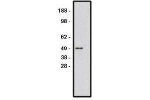 Image no. 1 for anti-Roundabout, Axon Guidance Receptor, Homolog 1 (ROBO1) antibody (ABIN265227) (ROBO1 anticorps)