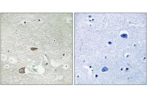 Immunohistochemistry analysis of paraffin-embedded human brain tissue, using CELSR2 Antibody. (CELSR2 anticorps  (AA 2781-2830))
