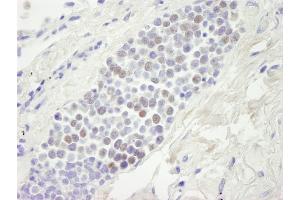 Immunohistochemistry (IHC) image for anti-Minichromosome Maintenance Deficient 4 (MCM4) (AA 325-375) antibody (ABIN7448653) (MCM4 anticorps  (AA 325-375))