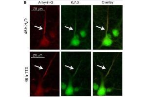 Cultured rat hippocampal neurons (DIV 11-12) were treated for 48 h with 1 μM TTX or its vehicle control (0. (Ankyrin G anticorps)