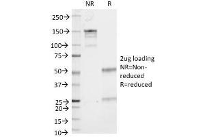 SDS-PAGE Analysis Purified CD53 Mouse Monoclonal Antibody (161-2). (CD53 anticorps)