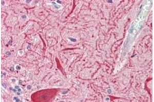 Human Brain, Cerebellum: Formalin-Fixed, Paraffin-Embedded (FFPE)