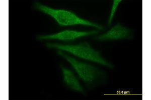 Immunofluorescence of monoclonal antibody to AKR1C4 on HepG2 cell.