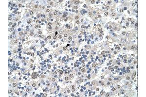 Immunohistochemistry (IHC) image for anti-Cerebellar Degeneration-Related Protein 2, 62kDa (CDR2) (N-Term) antibody (ABIN311402) (CDR2 anticorps  (N-Term))