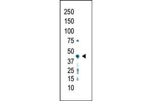 Western blot analysis of anti-PRMT2 Pab (ABIN387837 and ABIN2843934) in whole HL60 cell lysate was detected using purified Pab.